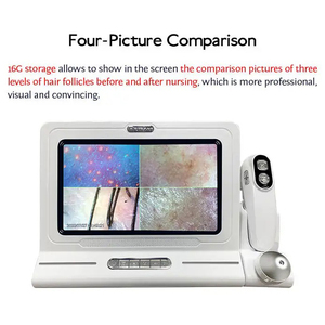 กล้อง HD วิเคราะห์ผิวหน้าและหนังศีรษะ พร้อม Wi-Fi ตรวจจับรูขุมขนอัจฉริยะ - Product Image 4