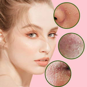 โท<span class=keywords><strong>น</strong></span>เนอร์บำรุงผิวห<span class=keywords><strong>น</strong></span>้าแตงโมเรืองแสง PHA + BHA บำรุงผิวอย่างอ่อ<span class=keywords><strong>น</strong></span>โย<span class=keywords><strong>น</strong></span>ครีมบำรุงให้ความชุ่มชื้นด้วยกรดไฮยาลูโรนิก - Product Image 4