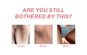 Crema blanqueadora para aclarar el cuerpo, lociones para el cuidado de la piel para axilas y partes privadas, crema blanqueadora para axilas para mujeres - Product Image 6