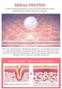 Siero proteico al <span class=keywords><strong>collagene</strong></span> per la cura della pelle per il viso | Cura delle rughe, invecchiamento della pelle opaca, schiarente, <span class=keywords><strong>elastina</strong></span>, <span class=keywords><strong>acido</strong></span> <span class=keywords><strong>ialuronico</strong></span>-281223 - Product Image 5