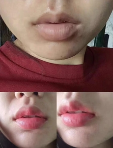 Vegan Waterproof <b>Lip</b> Balm & <b>Cream</b> Set with Blackhead Removal Powder Moisturizing Repair & Vitamin E - Product Image 6