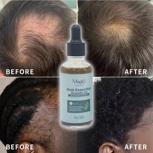 Alecrim Extrato Mágico Cabelo Crescimento Loção Alta Qualidade Private Label Hair Care Products Óleo Essencial 50ml para Preços por Atacado - Product Image 1