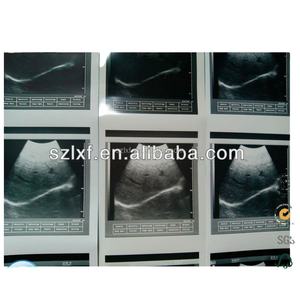 Papier thermique médical pour échographie 110S 110 HG - Product Image 2