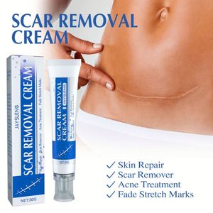 JAYSUING Crema <span class=keywords><strong>para</strong></span> Eliminar Cicatrices de Venta Caliente, Reparación de la Piel, Elimina Marcas de <span class=keywords><strong>Estrías</strong></span>, Efecto Rápido, Crema Anti-Cicatrices 30G JAYSUING - Product Image 3