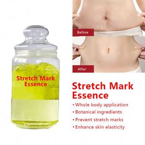 Crème de réparation de vergetures pour cicatrices Pregcy Abdomen Anti <span class=keywords><strong>Vergeture</strong></span> Crème d'élimination des vergetures au beurre de karité biologique pour - Product Image 2