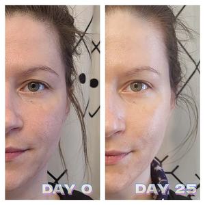 OEM Ghk-cu <span class=keywords><strong>เซ</strong></span><span class=keywords><strong>รั่</strong></span><span class=keywords><strong>ม</strong></span>ผงคิวเพปไทด์สีน้ำเงินเกรดเครื่องสำอาง ชนิดไลโอฟิไลซ์ สำหรับทาภายนอก ช่วย<span class=keywords><strong>ลด</strong></span>เลือนริ้วรอยและเส้นเล็ก - Product Image 3