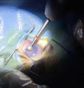 Attrezzature diagnostiche veterinarie per <span class=keywords><strong>cani</strong></span> gatti veterinari e oftalmologi - Product Image 2