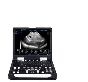 Laptop Pw Echografie Scanner Veterinarylaptop Pw Echografie Scanner Dierenarts - Product Image 1