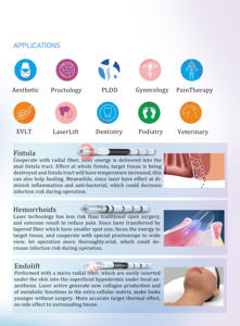 Fibra Óptica Radial SMA905 Endolaser (200um, 400um, 600um, 800um) para Lipólisis, Tratamiento de Venas Varicosas y Hemorroides - Product Image 6