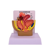 Modèle d'anatomie pelvienne féminine, spécimen du système génito-urinaire féminin, modèle pédagogique d'anatomie humaine