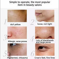 ZS Vente en gros Spongilla Spicules Crème Bio Microneedle Therapy Peel d'algues pour l'acné Vergetures et taches foncées Crème méso Spicule