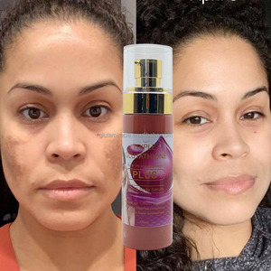 เซรั่มกลูต้าไธโอนเข้มข้นสามเท่า ผลิตภัณฑ์เครื่องสำอางเกาหลีสูตรเฉพาะ ช่วย<span class=keywords><strong>ลด</strong></span>เมลานิน รอยสิว จุดด่างดำ ปรับสีผิวให้สม่ำเสมอ และเพิ่มความชุ่มชื้น - Product Image 3