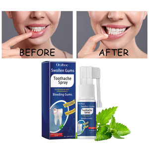 Spray buccal apaisant pour les maux de dents à la glycérine, extrait de menthe arvense, aloès et Yohji <span class=keywords><strong>Matsu</strong></span> Eksu – Soulage les gencives enflées, protège les dents et les dents et la bouche. - Product Image 3