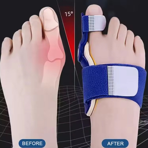 Séparateur d'orteils transfrontalier pour <span class=keywords><strong>hallux</strong></span> <span class=keywords><strong>valgus</strong></span> avec métal renforcé, taille unique, garantie à vie - Product Image 1