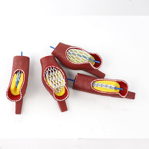 Modelo <span class=keywords><strong>de</strong></span> stent vascular <span class=keywords><strong>de</strong></span> ciencia médica modelo vascular humano enseñanza médica modelo <span class=keywords><strong>de</strong></span> <span class=keywords><strong>anatomía</strong></span> vascular <span class=keywords><strong>patológica</strong></span> - Product Image 6
