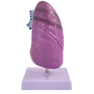 Modelo de pulmón patológico para fines de enseñanza médica - Product Image 4