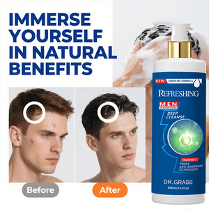 Shampooing pour hommes à marque privée, antipelliculaire, anti-chute, stimulant la croissance des cheveux, renforçant les racines et épaississant les cheveux - Product Image 6