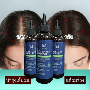 Private Label 100% Haarwuchsöl, Wurzel-Pflege, Haarstärkung, Kräuter-Rosmarin-Haarwuchsöl, Tägliches Haarwuchsöl - Product Image 1