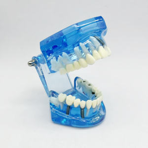 Modèle de réparation bleu école de médecine restauration des nerfs dentaires modèle humain modèle dentaire médical - Product Image 6