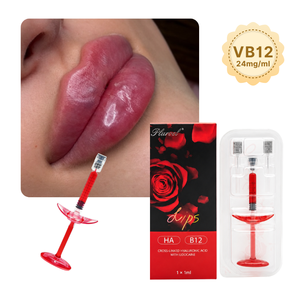 Acide hyaluronique réticulé le plus vendu VB12 1ml pour l'augmentation <span class=keywords><strong>des</strong></span> lèvres - Product Image 1
