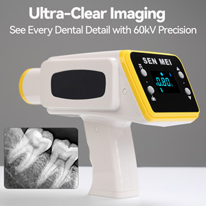 Equipo de Rayos X Dental Portátil de Alta Calidad para Clínica/Sensor RVG Digital con Sistema de Imagenología - Product Image 4