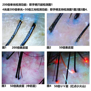 5in1 피부 분석기 헤어 오일 수분 분석 미용 퍼스널 케어 제품 헤어 두피 케어 머신 - Product Image 5