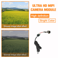 Module de caméra endoscopique USB2.0 5MP CMOS à autofocus, diamètre 11mm, 1080P FHD, module nu pour intégration compacte, Santé intelligente