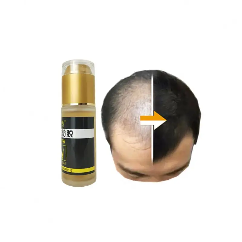 שמן טיפול Cherioll גדל חמאת קוויאר טיפות גורם של אובדן קיק יעיל מאן Chebe שיער צמיחת מוצרים