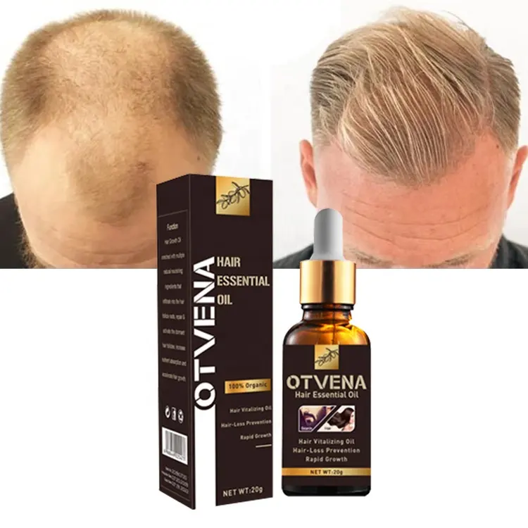 Hair Lotion High quality hair care repair Scalp treatment 100% Hair Growth Oil private label