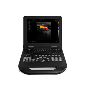 Mesin Doppler warna rumah sakit 3D, mesin <span class=keywords><strong>ultrasound</strong></span> portabel harga pabrik dengan kualitas tinggi - Product Image 2