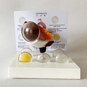 Modelo Anatómico Ampliado del Ojo Humano con 5 <span class=keywords><strong>Tipos</strong></span> <span class=keywords><strong>de</strong></span> Lentes <span class=keywords><strong>de</strong></span> Catarata para <span class=keywords><strong>la</strong></span> Enseñanza <span class=keywords><strong>de</strong></span> Oftalmología - Product Image 3