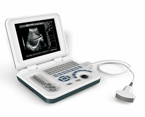 دفتر <span class=keywords><strong>S30</strong></span> الأكثر مبيعًا للموجات فوق الصوتية الطبية B/W S50A بالموجات فوق الصوتية ثنائي الأبعاد للحمل النسائي USG - Product Image 2