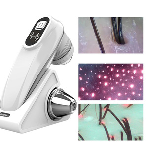 Analizador <span class=keywords><strong>de</strong></span> Cuero Cabelludo Inalámbrico Profesional 50X y 200X HD, Detector <span class=keywords><strong>de</strong></span> Folículos Pilosos, Microscopio Portátil <span class=keywords><strong>para</strong></span> Análisis <span class=keywords><strong>de</strong></span> Folículos, Masajeador - Product Image 6
