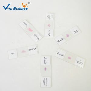 Vetrini per Microscopia dell'Istologia Dentale Umana, Quattro Fasi dello Sviluppo del Dente su Vetro, Vetrini Preparati per Parti della Bocca - Product Image 2