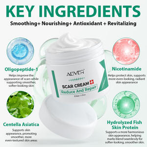 Crème personnalisée anti-acné et vergetures pour le visage et le corps, réparatrice des taches de rousseur et des cicatrices (chirurgie, blessures, brûlures, anciennes cicatrices) - Product Image 2