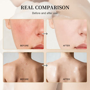 Jabón Exfoliante Artesanal de Marca Blanca con Avena y Aceite de Coco - Limpiador Antiinflamatorio, Iluminador e Hidratante <span class=keywords><strong>para</strong></span> Todo Tipo de Piel - Product Image 4