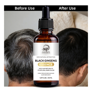 เซรั่มบำรุงผมขาวให้กลับดำ ป้องกันผมหงอก ฟอ-ติ ออร์แกนิคจากธรรมชาติ ขายส่ง ช่วยบำรุงสุขภาพเส้นผม - Product Image 6