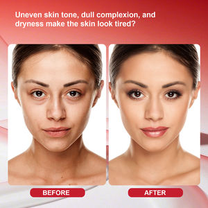 Verlichtende <span class=keywords><strong>Lycopene</strong></span> Gezichtsolie 30ml Anti-veroudering Anti-rimpel Voedende Hydraterende Glycerine Hoofdingrediënt Alle Huidtypen Op Maat - Product Image 4