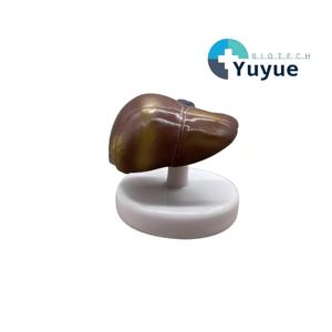 Modèle pédagogique biologique de pathologie hépatique avec base - Outil de démonstration anatomique pour l'enseignement de la hépatologie - Product Image 1