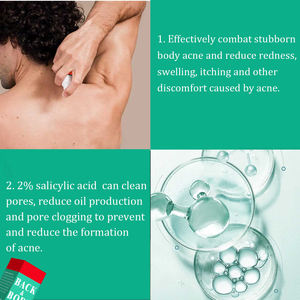 สเปรย์รักษาสิวเพื่อเพิ่มความชุ่มชื้นให้ผิวลดอาการบวมและแดงช่วยผ่อนคลายรูขุมขนและ<span class=keywords><strong>หลัง</strong></span>ร่างกาย - Product Image 4