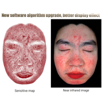 Nouvel Analyseur Portable 3D IA de Diagnostic Cutané Facial 2025 – Scanner et Testeur de Peau pour l'Analyse Faciale