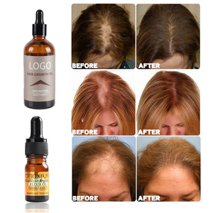 Dầu Dưỡng Tóc Biotin Germinal Dầu Dưỡng Tóc Hữu Cơ Để Lại Trong Gừng Nhãn Hiệu Riêng Tùy Chỉnh Serum Mọc Tóc Keratin Hữu Cơ - Product Image 3