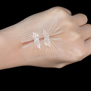 創傷閉鎖創傷閉鎖器 手術用創傷閉鎖器 - Product Image 2