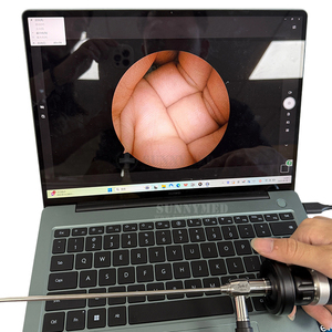 Gynecology Obstetrical Sigmoidoscopy <strong>Instruments</strong> Sets Anoscopes Proctoscope Gyne Ob Electric Sigmoidoscope Camera Set - Product Image 2