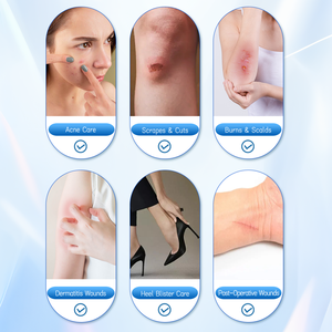 แผ่นปิดแผลไฮโดรคอลลอยด์แบบม้วนใส ปราศจากน้ำยาง ปลอดภัยต่อผิว ได้มาตรฐานทางการแพทย์ สำหรับดูแลสิวและ<span class=keywords><strong>แผล</strong></span>พุพอง ได้รับการรับรองมาตรฐาน CE/ISO - Product Image 4