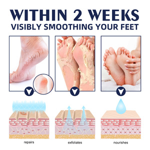 <span class=keywords><strong>Crema</strong></span> mani <span class=keywords><strong>e</strong></span> piedi nutriente, idratante <span class=keywords><strong>e</strong></span> <span class=keywords><strong>antibatterica</strong></span> con logo personalizzato - Product Image 5