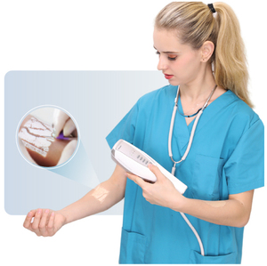Nhà Máy Giá tĩnh mạch di động Finder vô ích Viewer hồng ngoại con người trên khuôn mặt cơ thể và veterinaryvein định vị với CE - Product Image 2