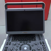 Sonoscape E2 Máquina de ultrasonido portátil 15,6 "HD Color Doppler Ultrasonido médico para clínica veterinaria humana o equipo de hospital