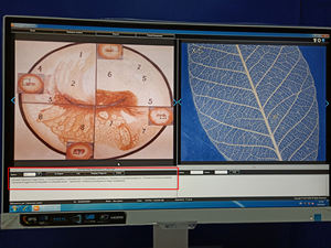 Kernel portátil Beautiful Vagina Video Colposcope Kn2200 para Exame De Ginecologia - Product Image 4