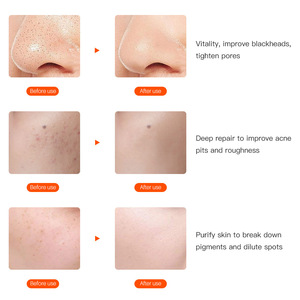 <span class=keywords><strong>BEPERFECT</strong></span> – masque Facial WIFI pour la peau, masques faciaux, thérapie par la lumière Led rouge - Product Image 5